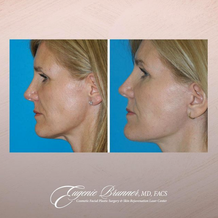 Eugenie Brunner, MD, FACS - Princeton, NJ