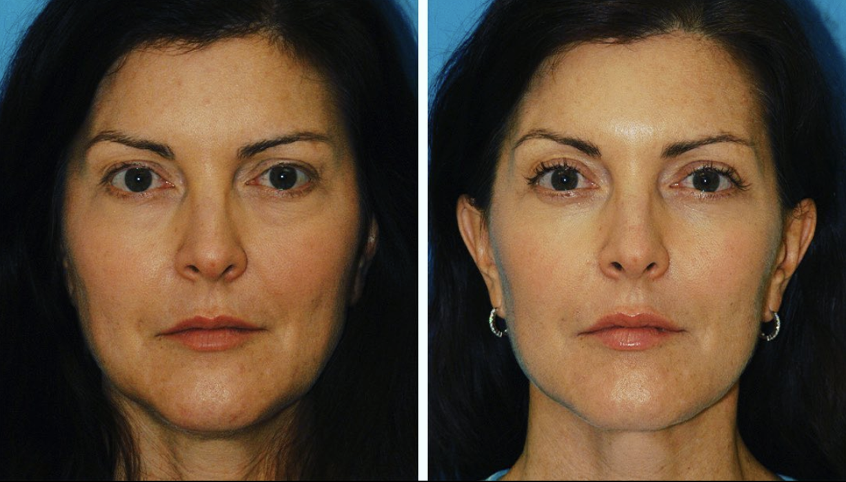 Eugenie Brunner, MD, FACS - Princeton, NJ