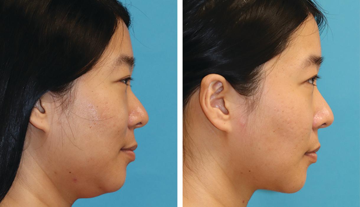 Eugenie Brunner, MD, FACS - Princeton, NJ