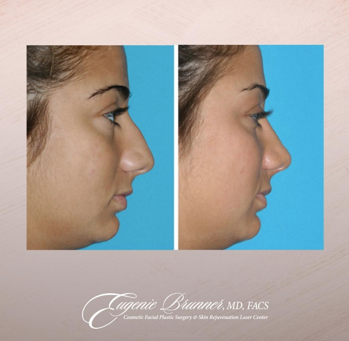 Eugenie Brunner, MD, FACS - Princeton, NJ