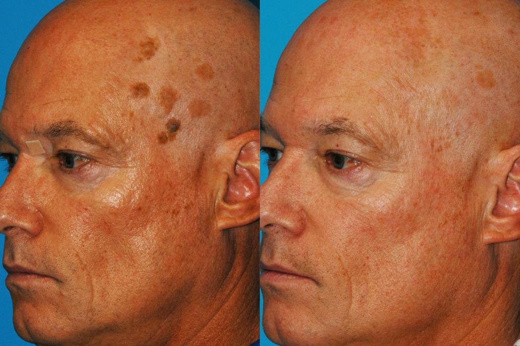 Eugenie Brunner, MD, FACS - Princeton, NJ