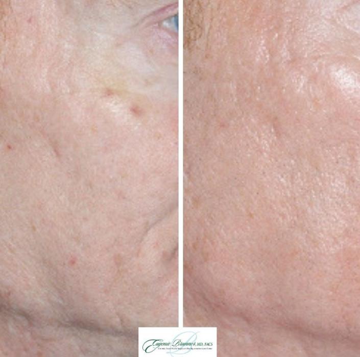 Eugenie Brunner, MD, FACS - Princeton, NJ