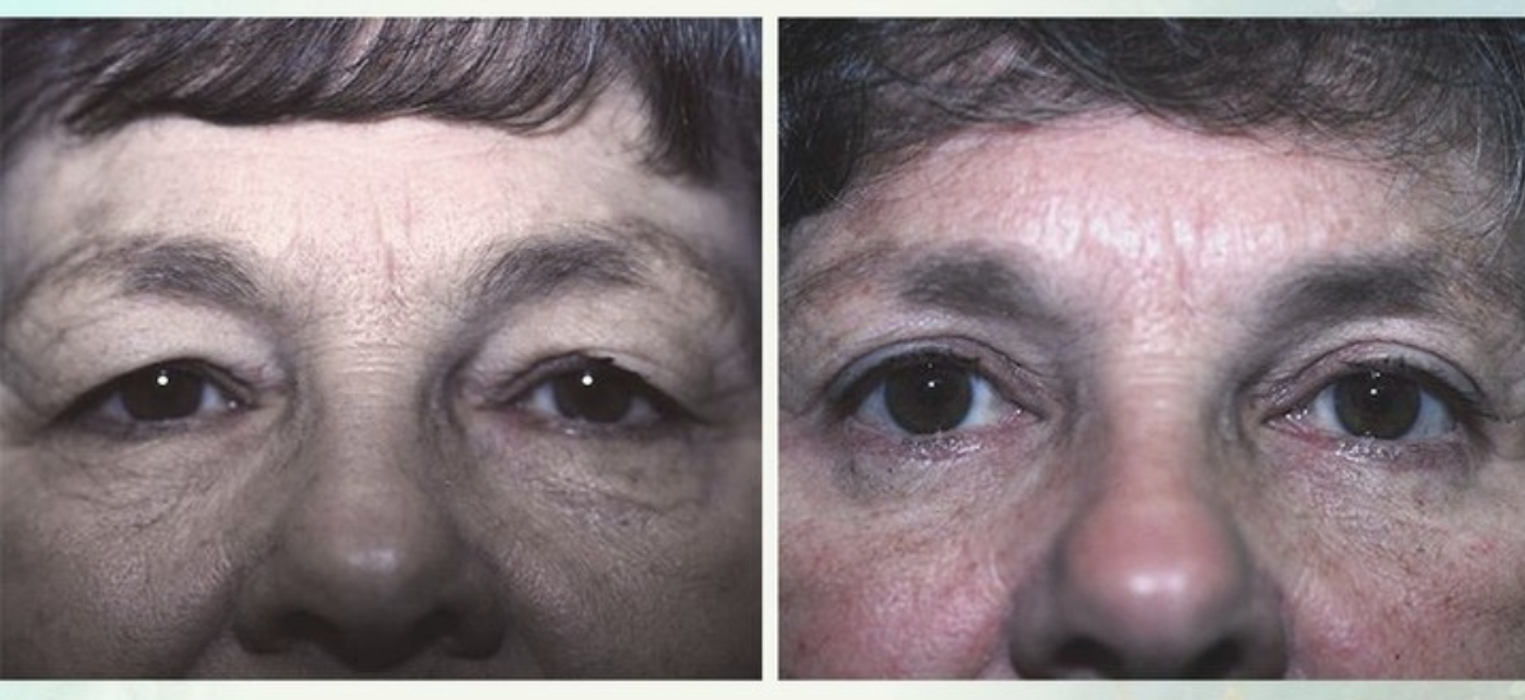 Eugenie Brunner, MD, FACS - Princeton, NJ