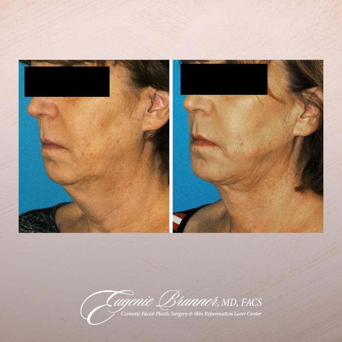 Eugenie Brunner, MD, FACS - Princeton, NJ