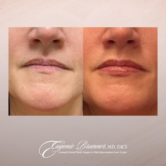 Eugenie Brunner, MD, FACS - Princeton, NJ