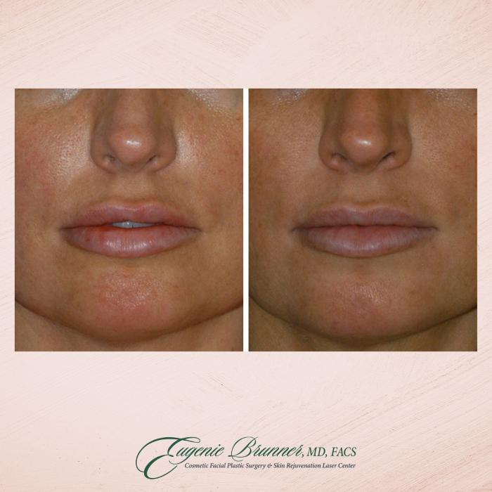 Eugenie Brunner, MD, FACS - Princeton, NJ