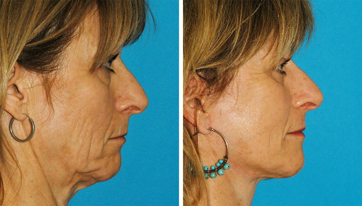 Eugenie Brunner, MD, FACS - Princeton, NJ