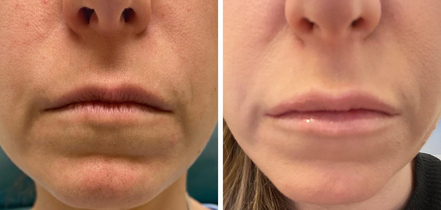 Eugenie Brunner, MD, FACS - Princeton, NJ