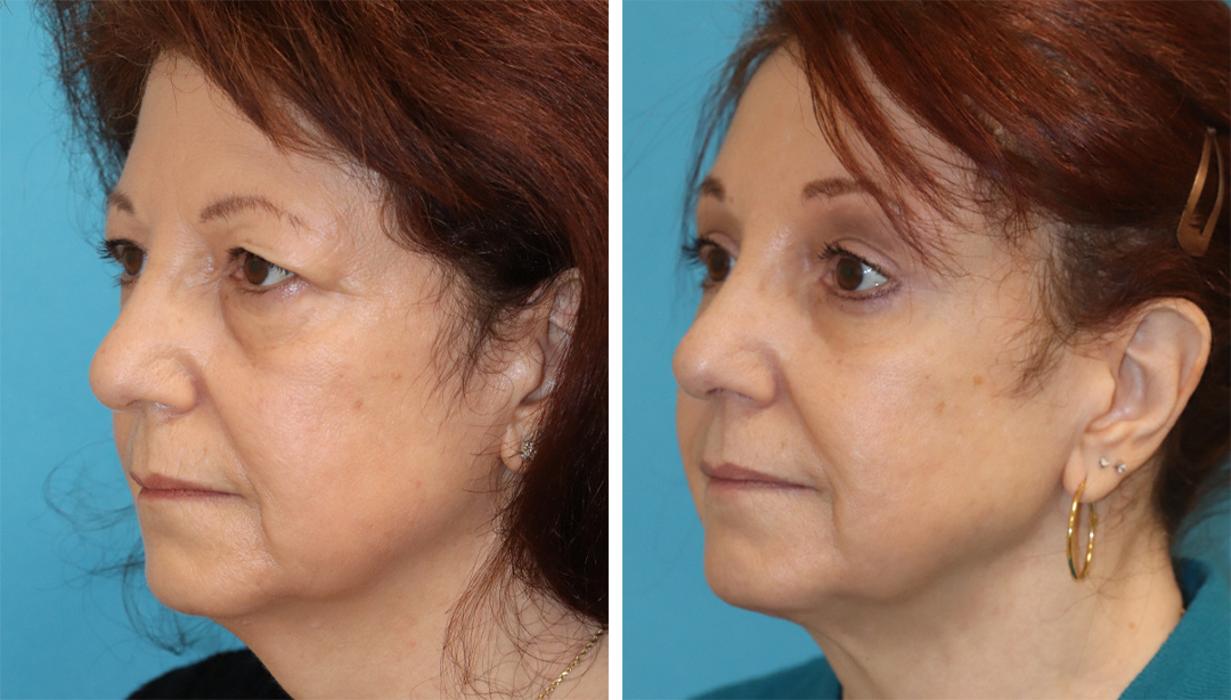 Eugenie Brunner, MD, FACS - Princeton, NJ