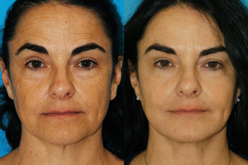 Eugenie Brunner, MD, FACS - Princeton, NJ