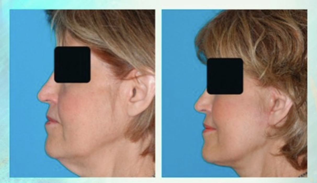 Eugenie Brunner, MD, FACS - Princeton, NJ