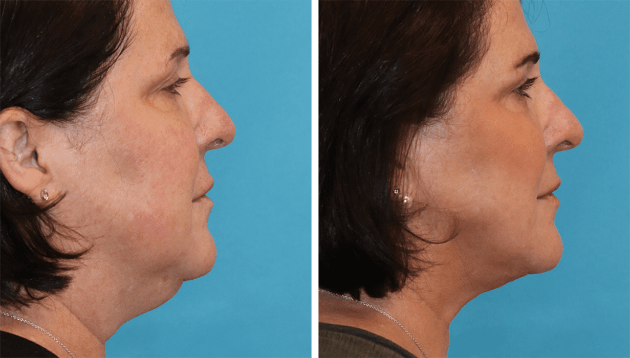 Eugenie Brunner, MD, FACS - Princeton, NJ