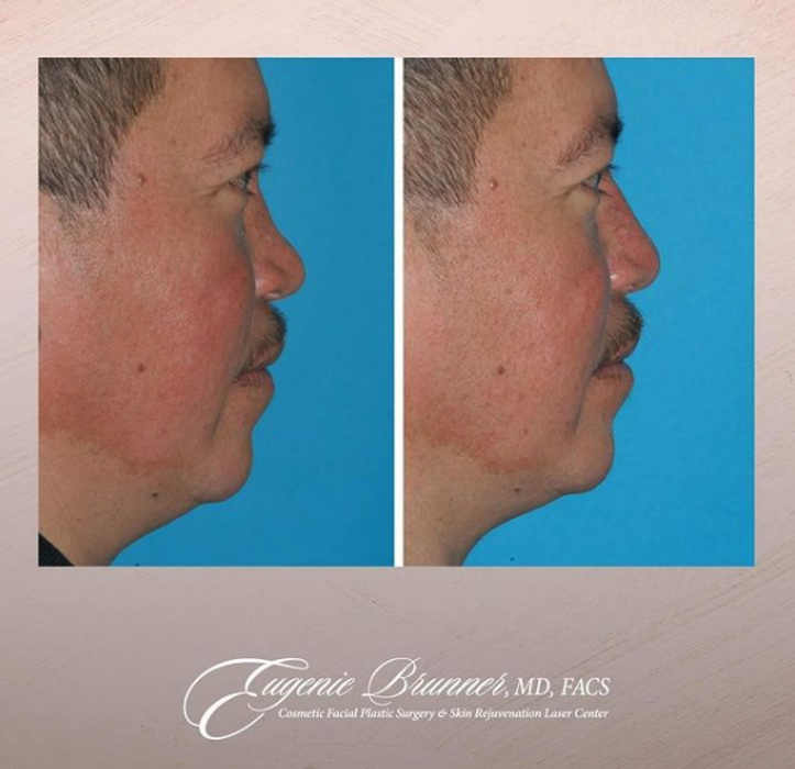 Eugenie Brunner, MD, FACS - Princeton, NJ