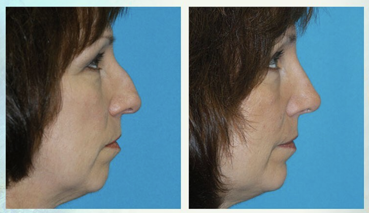 Eugenie Brunner, MD, FACS - Princeton, NJ