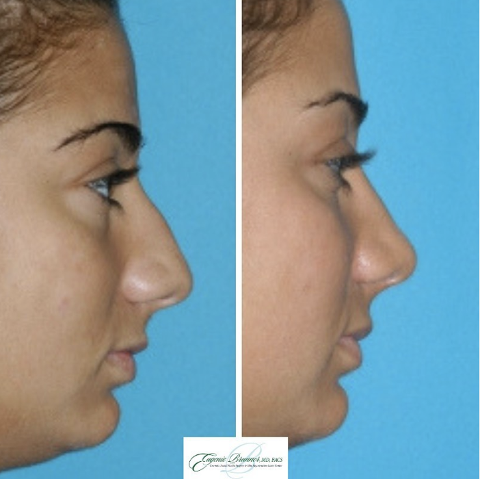 Eugenie Brunner, MD, FACS - Princeton, NJ