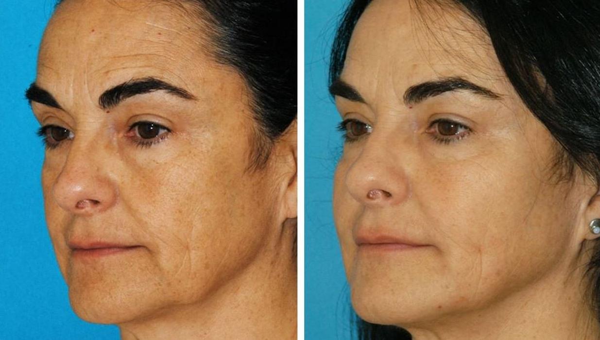 Eugenie Brunner, MD, FACS - Princeton, NJ