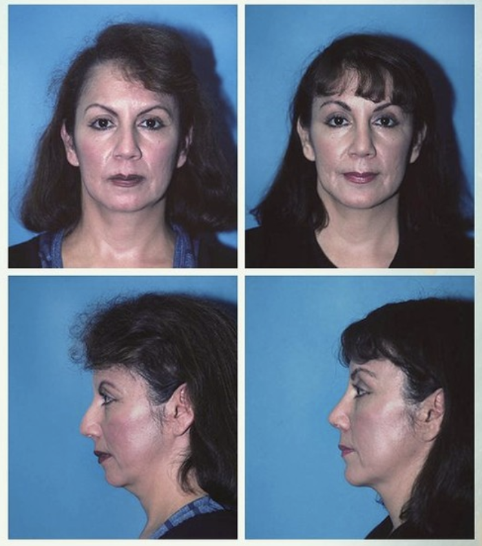 Eugenie Brunner, MD, FACS - Princeton, NJ