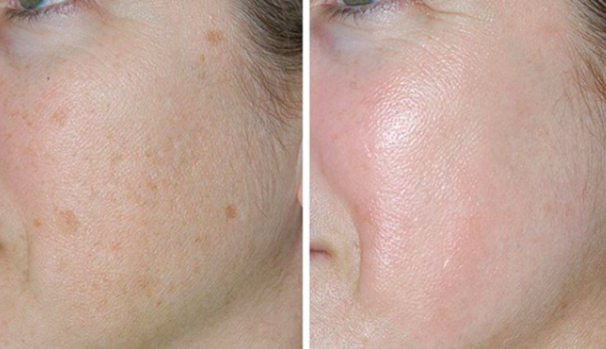 Eugenie Brunner, MD, FACS - Princeton, NJ