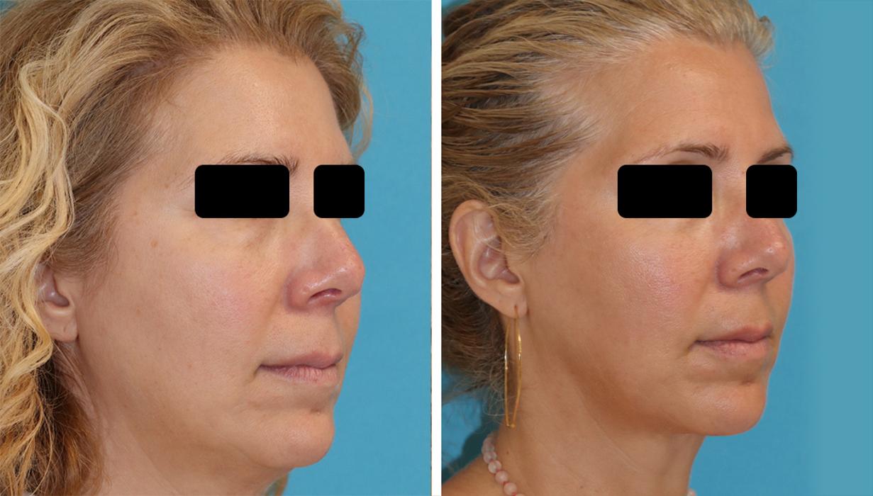 Eugenie Brunner, MD, FACS - Princeton, NJ