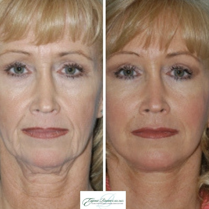 Eugenie Brunner, MD, FACS - Princeton, NJ