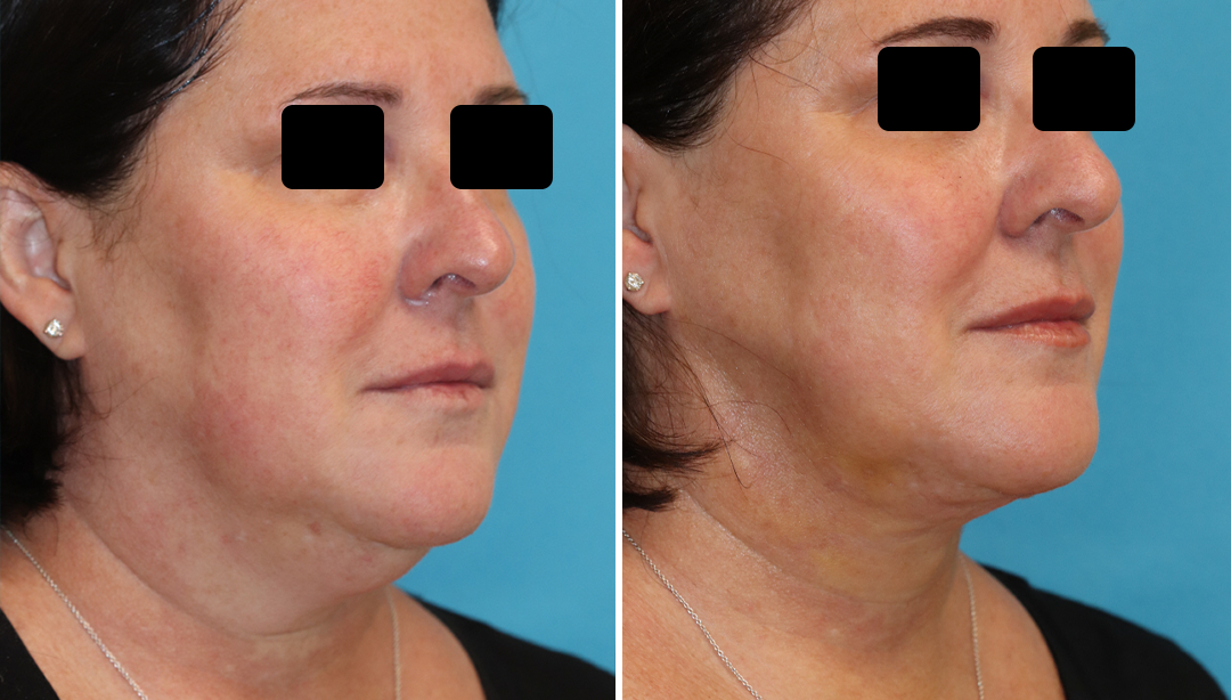 Eugenie Brunner, MD, FACS - Princeton, NJ