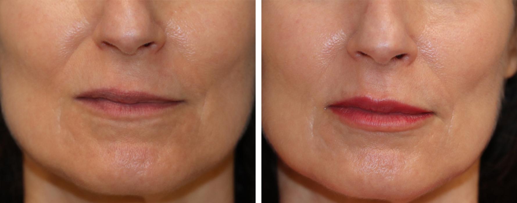 Eugenie Brunner, MD, FACS - Princeton, NJ