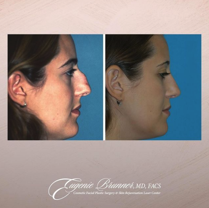 Eugenie Brunner, MD, FACS - Princeton, NJ