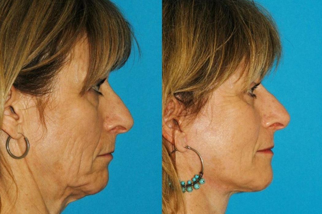 Eugenie Brunner, MD, FACS - Princeton, NJ