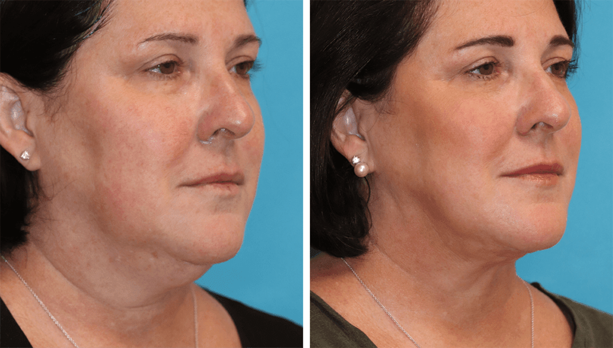 Eugenie Brunner, MD, FACS - Princeton, NJ