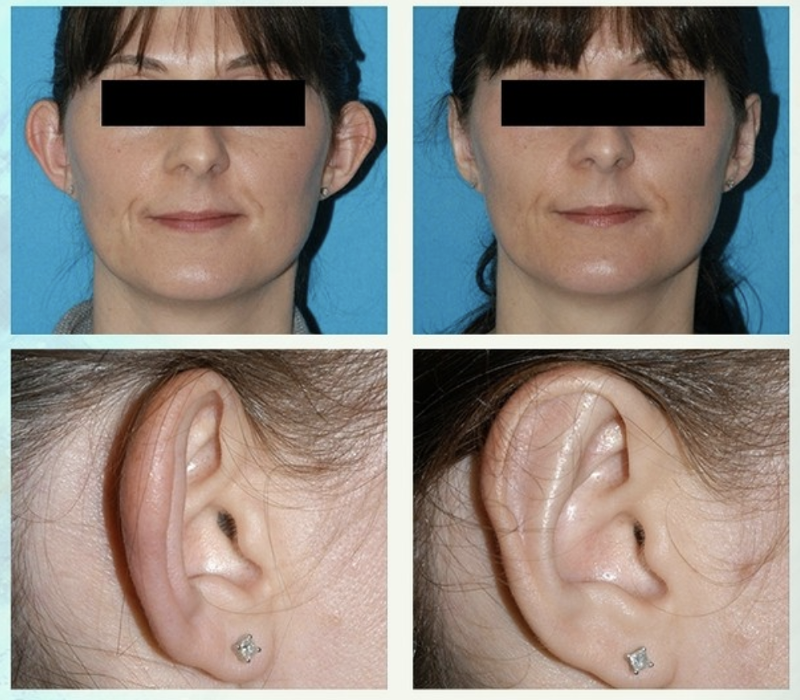 Eugenie Brunner, MD, FACS - Princeton, NJ