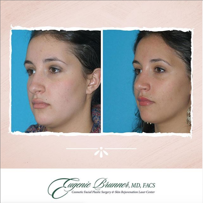 Eugenie Brunner, MD, FACS - Princeton, NJ