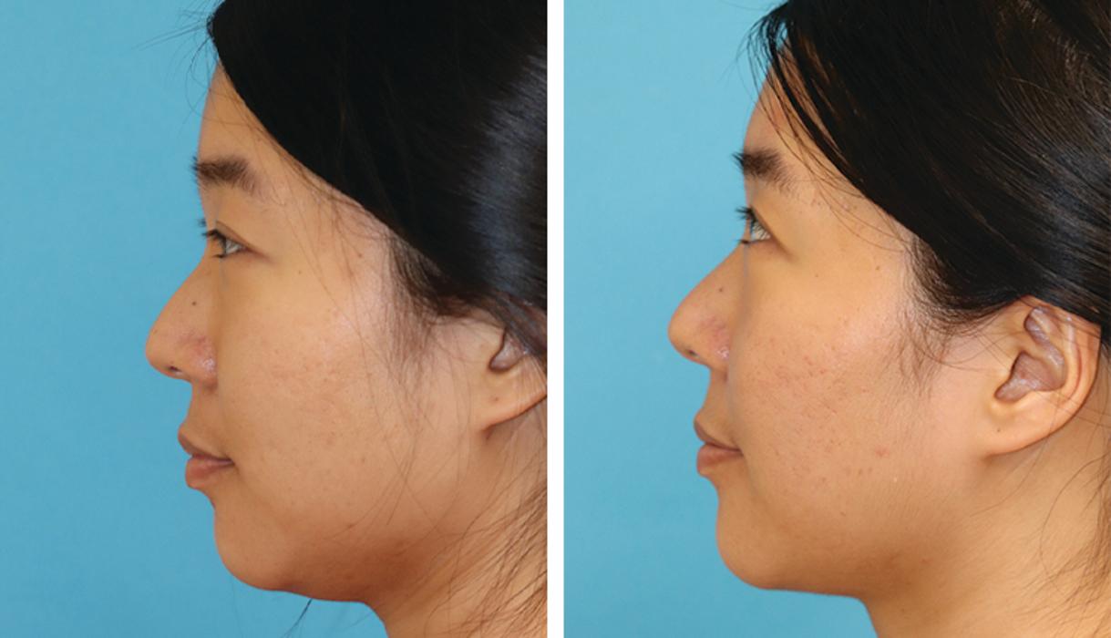 Eugenie Brunner, MD, FACS - Princeton, NJ