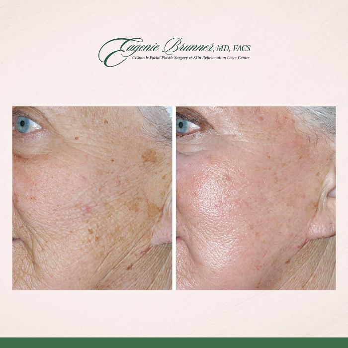 Eugenie Brunner, MD, FACS - Princeton, NJ