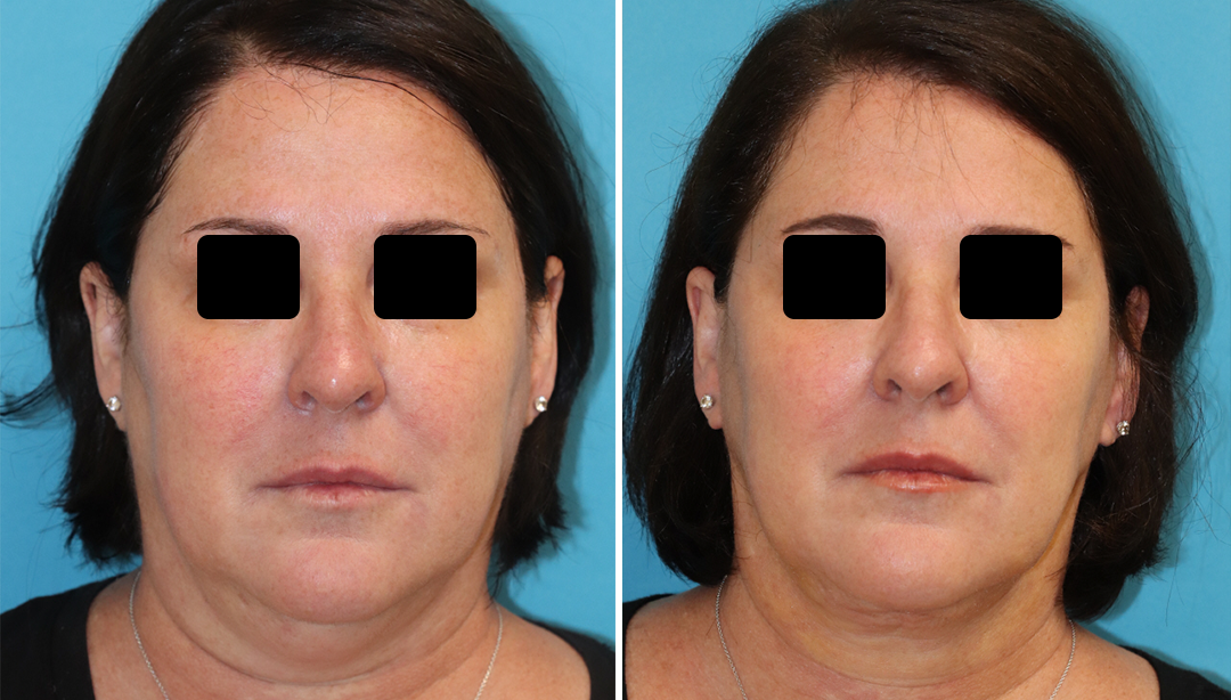 Eugenie Brunner, MD, FACS - Princeton, NJ