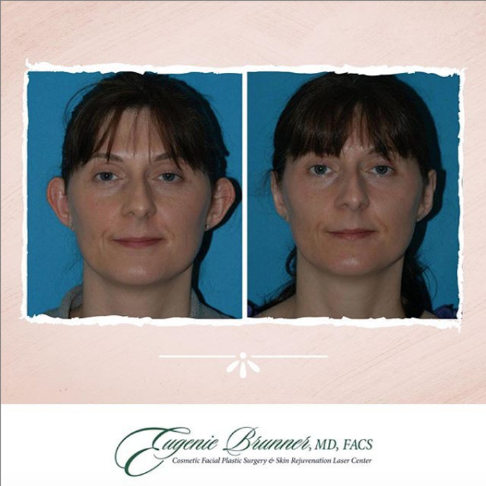 Eugenie Brunner, MD, FACS - Princeton, NJ