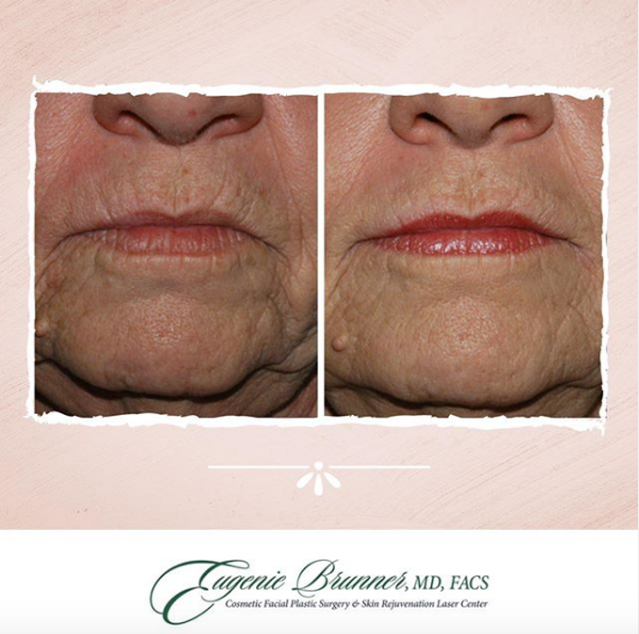 Eugenie Brunner, MD, FACS - Princeton, NJ