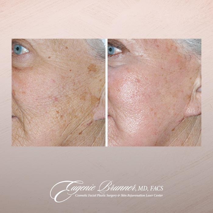 Eugenie Brunner, MD, FACS - Princeton, NJ