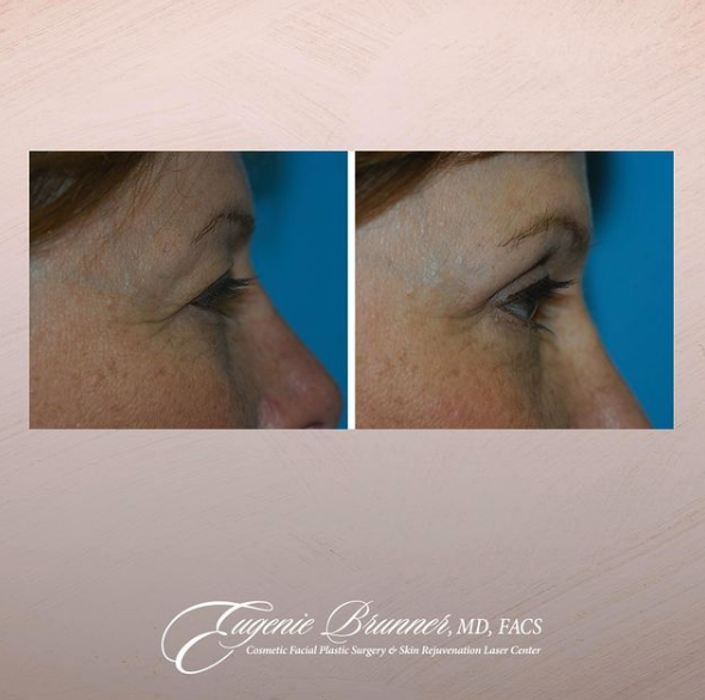 Eugenie Brunner, MD, FACS - Princeton, NJ