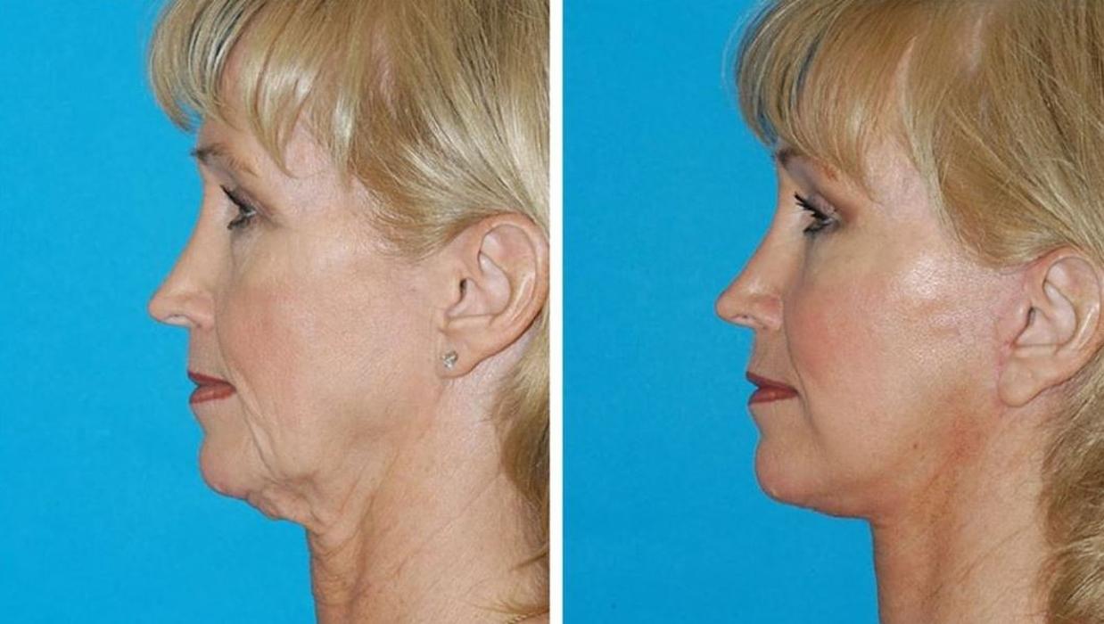 Eugenie Brunner, MD, FACS - Princeton, NJ