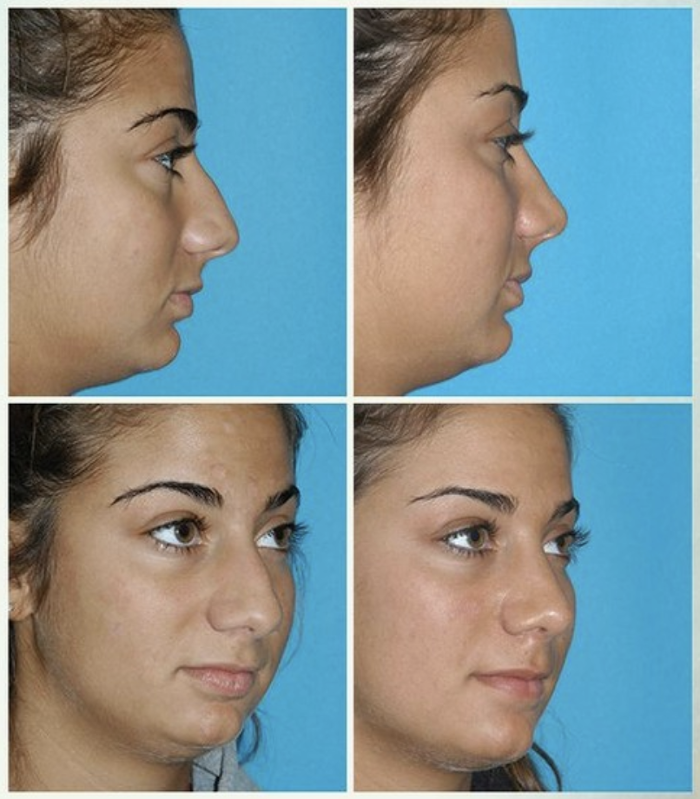 Eugenie Brunner, MD, FACS - Princeton, NJ