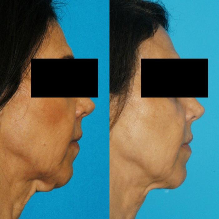 Eugenie Brunner, MD, FACS - Princeton, NJ