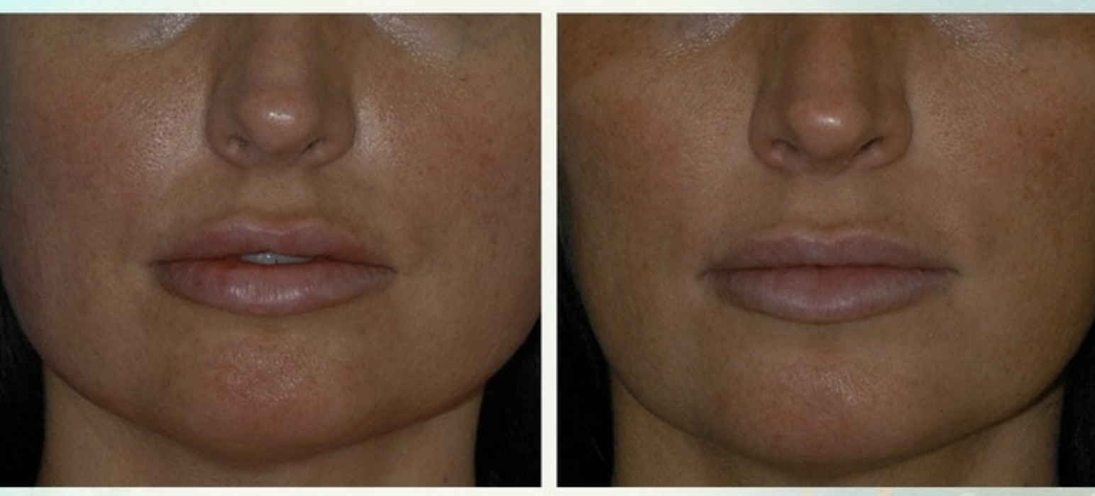 Eugenie Brunner, MD, FACS - Princeton, NJ