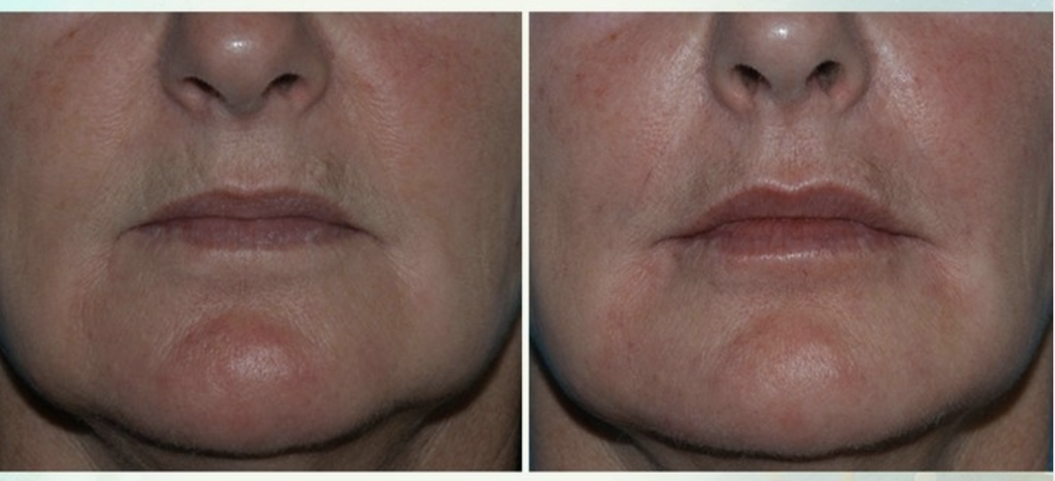 Eugenie Brunner, MD, FACS - Princeton, NJ