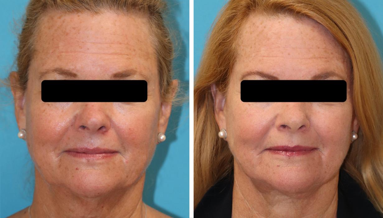 Eugenie Brunner, MD, FACS - Princeton, NJ