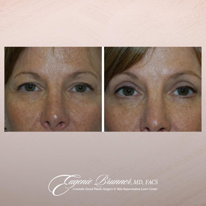 Eugenie Brunner, MD, FACS - Princeton, NJ