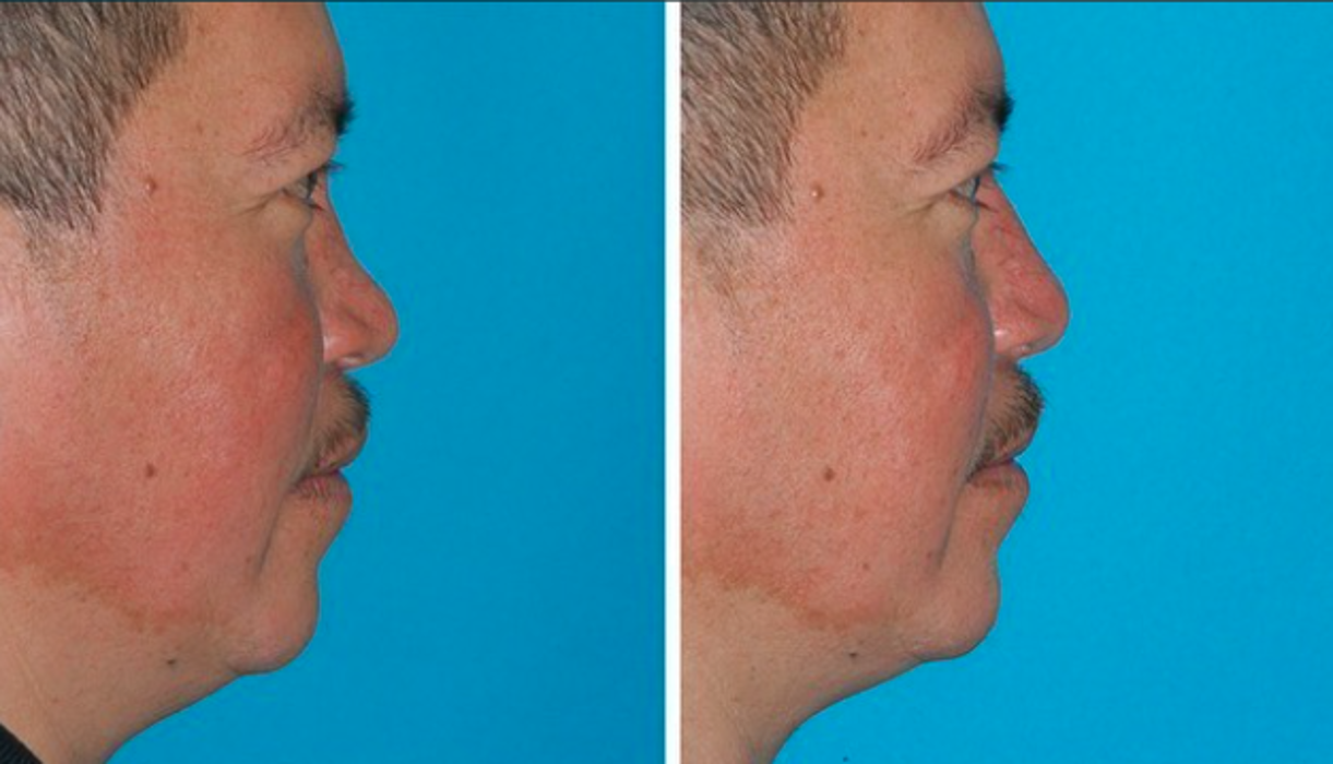 Eugenie Brunner, MD, FACS - Princeton, NJ