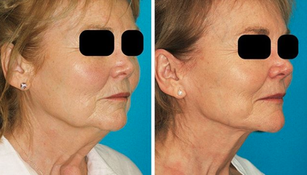 Eugenie Brunner, MD, FACS - Princeton, NJ