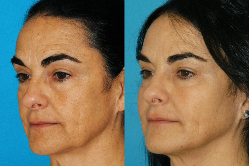 Eugenie Brunner, MD, FACS - Princeton, NJ