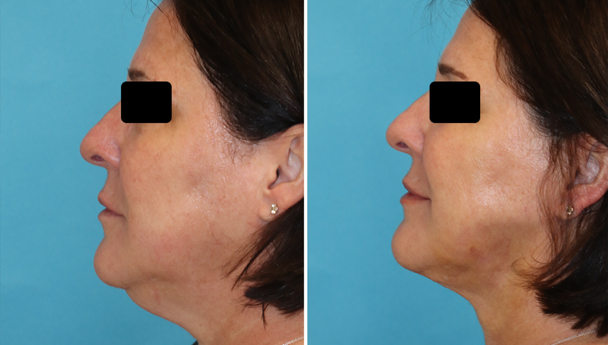 Eugenie Brunner, MD, FACS - Princeton, NJ