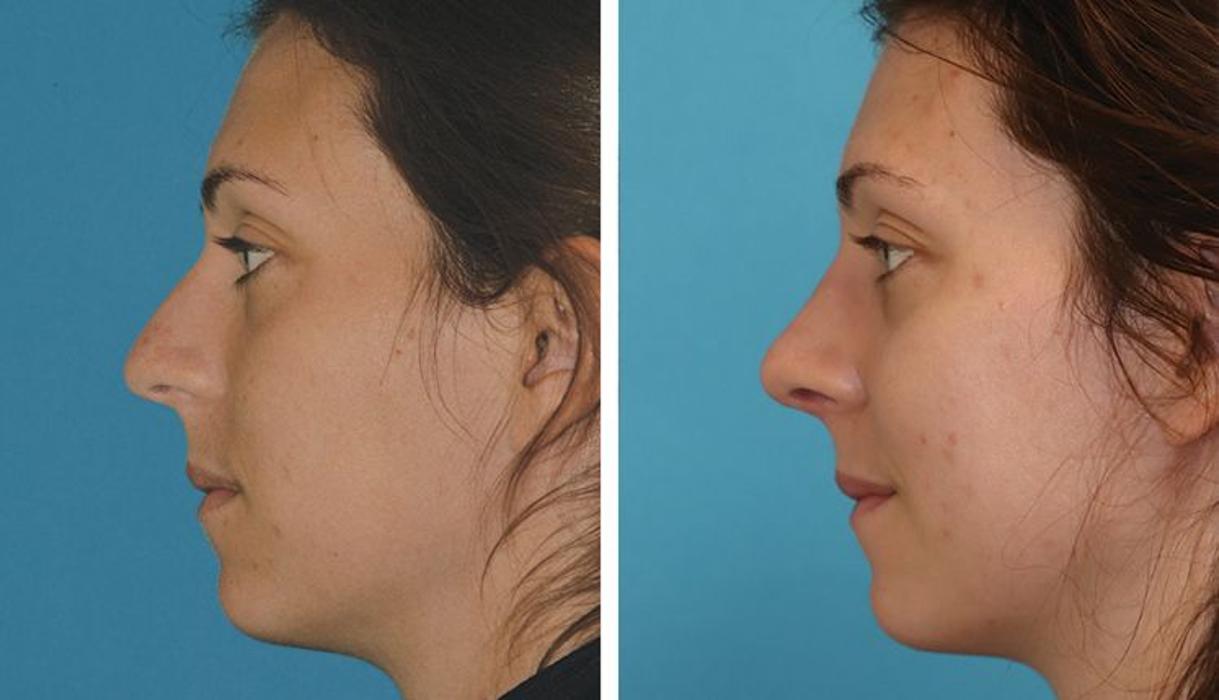 Eugenie Brunner, MD, FACS - Princeton, NJ